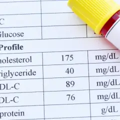 Wynik lipidogramu: cholesterol 175, trójglicerydy 40. Co to są trójglicerydy? To rodzaj tłuszczu we krwi.