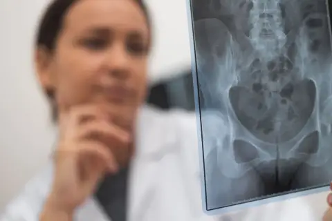 Lekarka analizuje zdjęcie RTG miednicy, szukając oznak złamania kości biodrowej.