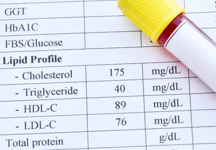 Wynik lipidogramu: cholesterol 175, trójglicerydy 40. Co to są trójglicerydy? To rodzaj tłuszczu we krwi.