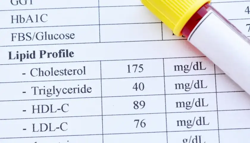 Wynik lipidogramu: cholesterol 175, trójglicerydy 40. Co to są trójglicerydy? To rodzaj tłuszczu we krwi.