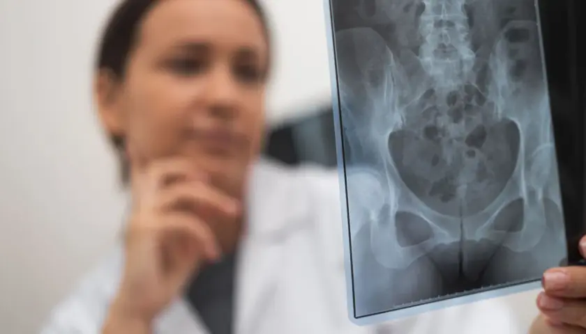 Lekarka analizuje zdjęcie RTG miednicy, szukając oznak złamania kości biodrowej.