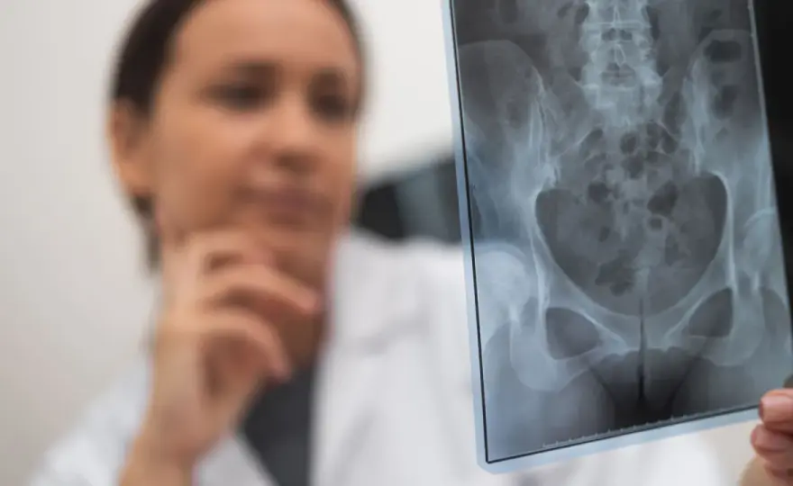 Złamanie kości biodrowej u seniora - objawy, leczenie, rehabilitacja