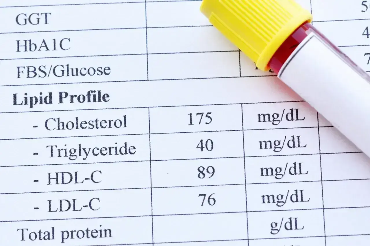 Wynik lipidogramu: cholesterol 175, trójglicerydy 40. Co to są trójglicerydy? To rodzaj tłuszczu we krwi.