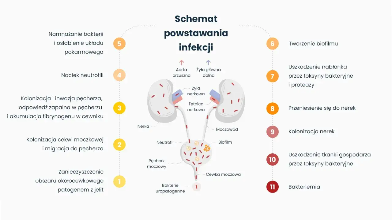 Schemat powstawania infekcji dróg moczowych, od zanieczyszczenia do bakteriemii, uwzględniający uszkodzenia nabłonka przez toksyny bakteryjne i uroner skutki uboczne.