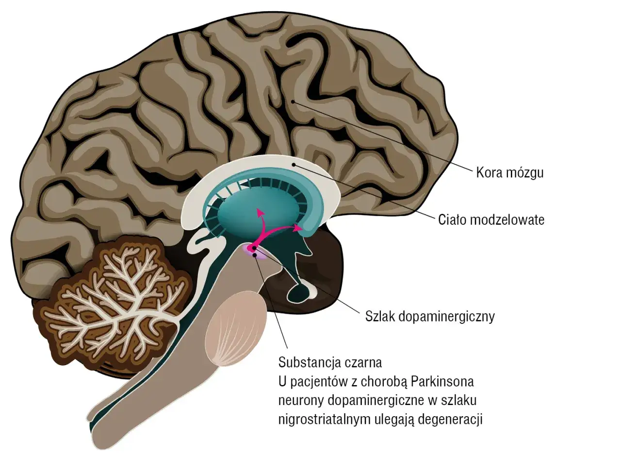 Mózg i neuroprzekaźniki w chorobie Parkinsona