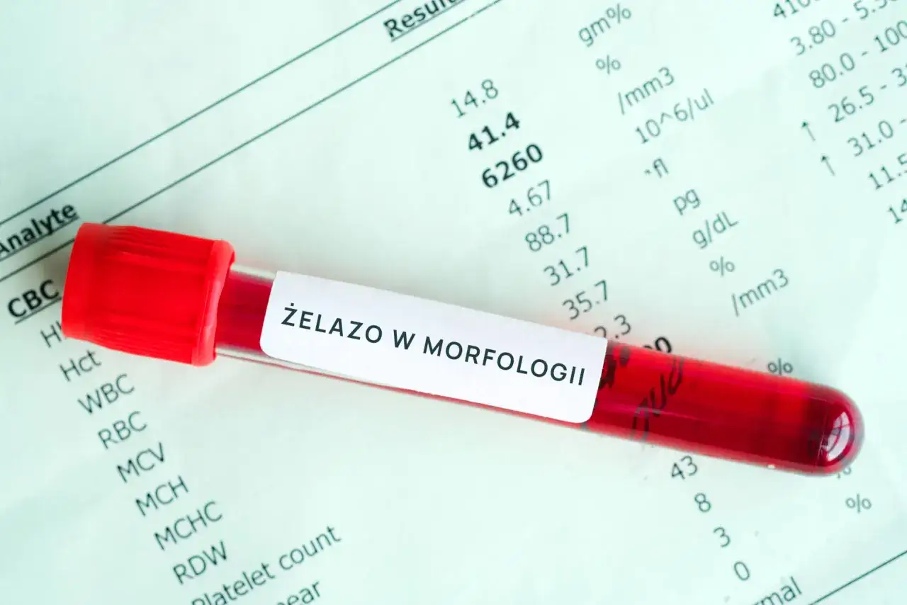 badania krwi niedobór żelaza, ferrytyna morfologia