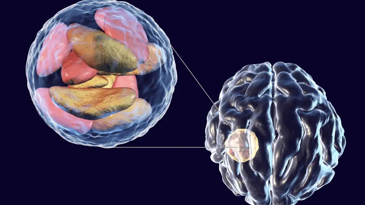 Toxoplasma gondii cykl życiowy wpływ na mózg