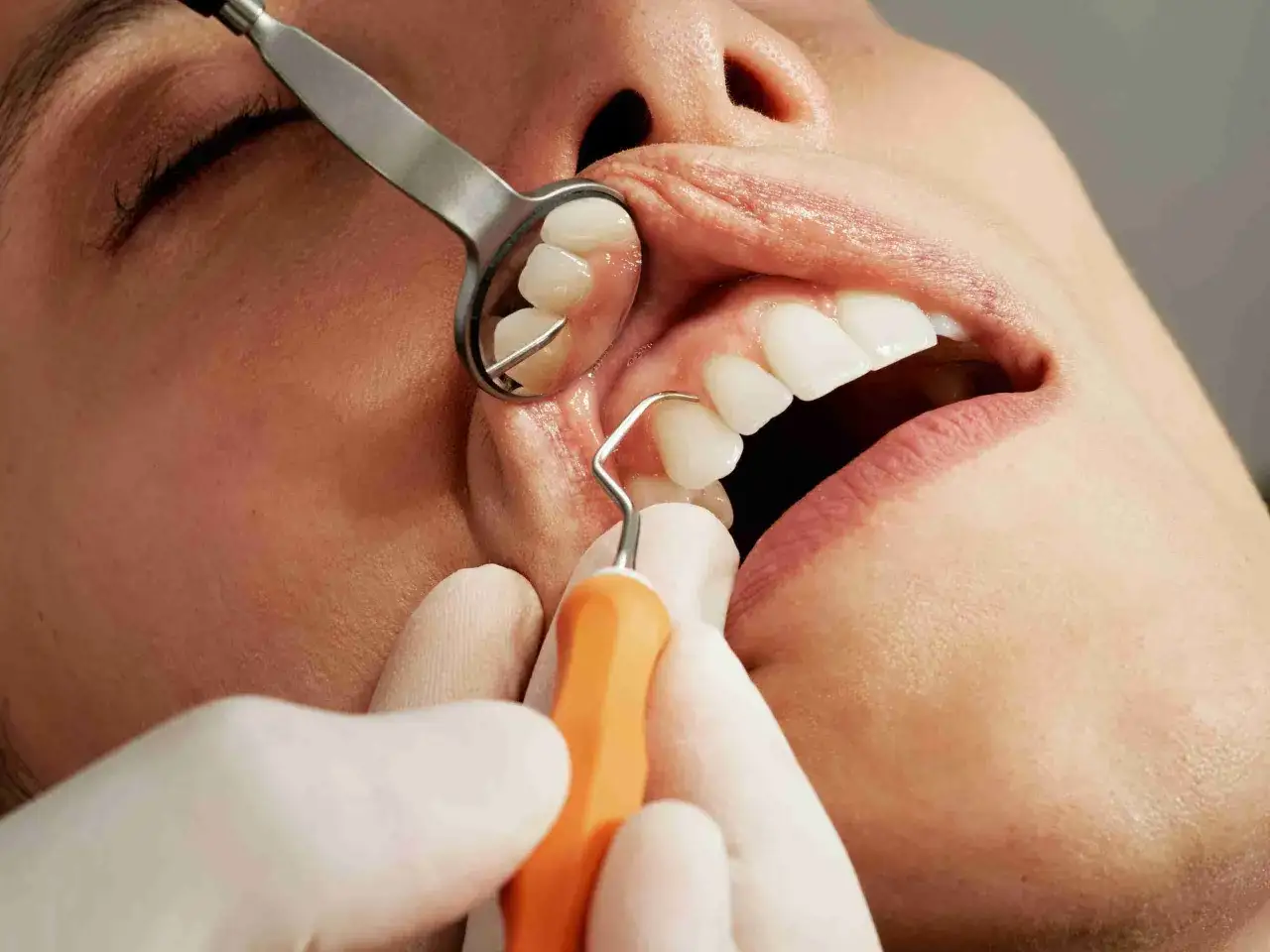 Dentysta bada zęby pacjenta, używając lusterka i narzędzia. Może to być etap diagnozy przed przepisaniem antybiotyku na zęba.
