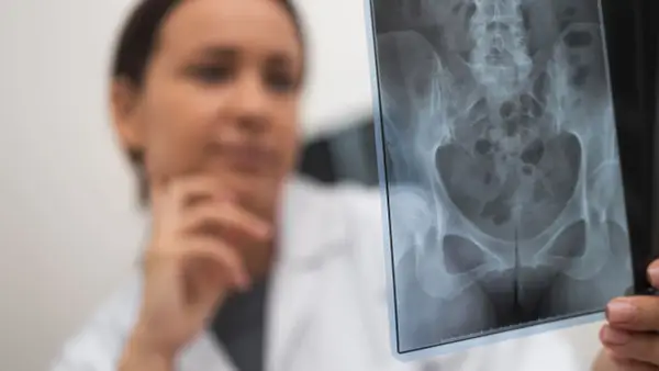 Lekarka analizuje zdjęcie RTG miednicy, szukając oznak złamania kości biodrowej.