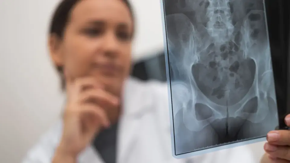 Złamanie kości biodrowej u seniora - objawy, leczenie, rehabilitacja